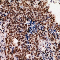 19 - Anti-hnRNP UL2 Antibody AP60962
