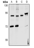 1 - Anti-hnRNP UL2 Antibody AP60962