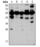 1 - Anti-HOXA5 Antibody AP60963
