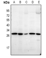 1 - Anti-LDLRAD1 Antibody AP60967