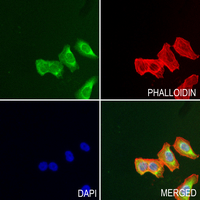 3 - Anti-Mannose Binding Protein Antibody AP60969