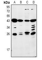 1 - Anti-Mannose Binding Protein Antibody AP60969