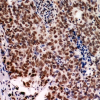 19 - Anti-NARFL Antibody AP60970