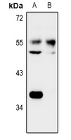 1 - Anti-NARFL Antibody AP60970