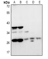 1 - Anti-NRBF2 Antibody AP60971