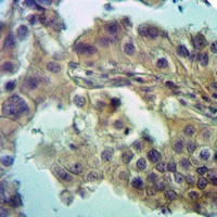 19 - Anti-ZDHHC15 Antibody AP60973