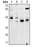 1 - Anti-ZDHHC15 Antibody AP60973