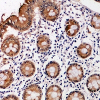 19 - Anti-PI3K p101 Antibody AP60974