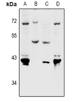 1 - Anti-Nectin 4 Antibody AP60975
