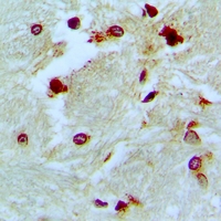 19 - Anti-p46 Antibody AP60976