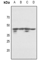 1 - Anti-p46 Antibody AP60976