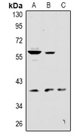1 - Anti-KCNK12 Antibody AP60977