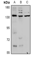 1 - Anti-KCNT1 Antibody AP60978
