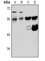1 - Anti-Kv5.1 Antibody AP60979