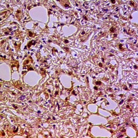 19 - Anti-Gemin3 Antibody AP60980