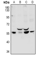 1 - Anti-PPP1R16B Antibody AP60981