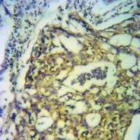 19 - Anti-PPM1L Antibody AP60982