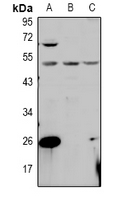 1 - Anti-PPM1L Antibody AP60982