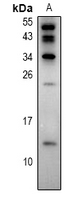1 - Anti-S100-Z Antibody AP60983