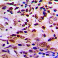 19 - Anti-PDXDC1 Antibody AP60985