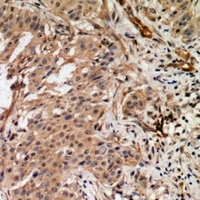 19 - Anti-RAB3GAP2 Antibody AP60986
