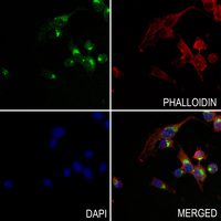 3 - Anti-RAB18 Antibody AP60987