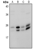 1 - Anti-RAB18 Antibody AP60987