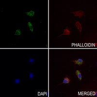 3 - Anti-RAB1B Antibody AP60988