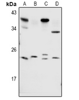1 - Anti-RAB1B Antibody AP60988