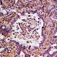 19 - Anti-RGS14 Antibody AP60989