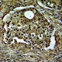 19 - Anti-ARHGEF12 Antibody AP60990