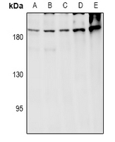1 - Anti-ARHGEF12 Antibody AP60990