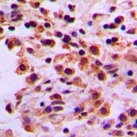 19 - Anti-ARHGEF19 Antibody AP60991