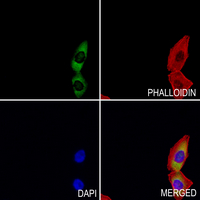 3 - Anti-SLY1 Antibody AP60994