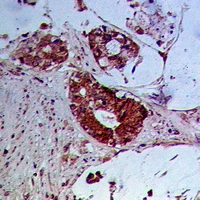 19 - Anti-SLY1 Antibody AP60994