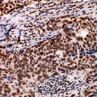 19 - Anti-PDIK1L Antibody AP60996