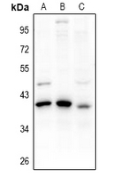1 - Anti-PDIK1L Antibody AP60996