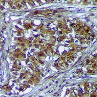 19 - Anti-PLK3 Antibody AP60998