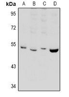 1 - Anti-PPP2R2B Antibody AP61000