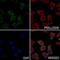 3 - Anti-Serpin B12 Antibody AP61001