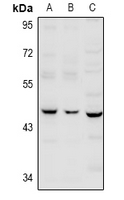 1 - Anti-Serpin B12 Antibody AP61001