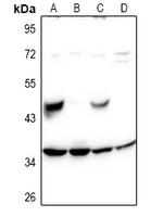 1 - Anti-SH2D5 Antibody AP61002