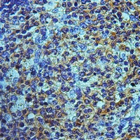 19 - Anti-OATP2 Antibody AP61003