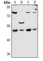 1 - Anti-SYT11 Antibody AP61004