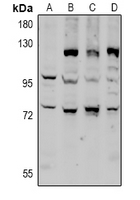 1 - Anti-CD6 Antibody AP61005