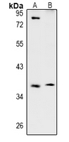 1 - Anti-TSSK4 Antibody AP61006