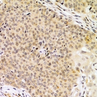 19 - Anti-KPC2 Antibody AP61009