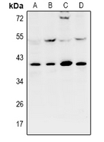 1 - Anti-KPC2 Antibody AP61009