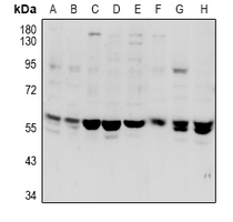 1 - Anti-VANGL1 Antibody AP61010