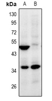 1 - Anti-ZNF771 Antibody AP61012